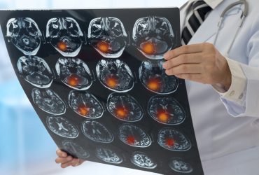 6 façons de se débarrasser du rhume de cerveau