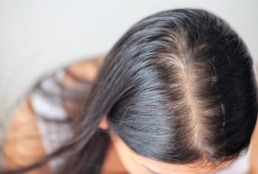 Comment obtenir un cuir chevelu sain et rajeunir les cheveux ?