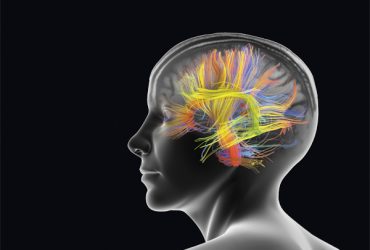 Comment savoir si votre cerveau est hyperactif ?
