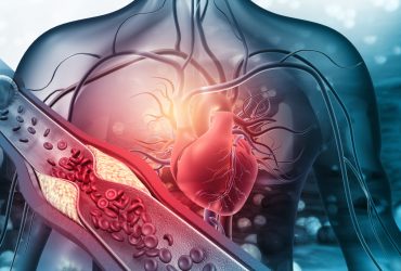 Facteurs de risque cardiovasculaire et comment les prévenir