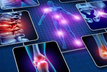 Que sont les inflammations articulaires et comment y remédier ?