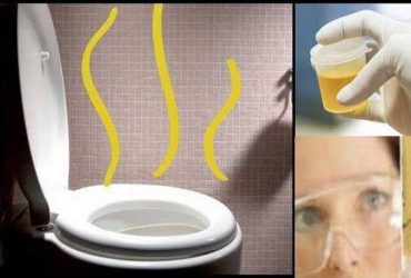 Votre urine a-t-elle une odeur?
