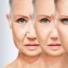 beauty concept skin aging. anti aging procedures, rejuvenation, lifting,