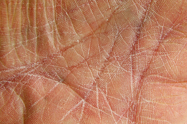 the palm of a rough and worn human hand showing dry skin. close up.
