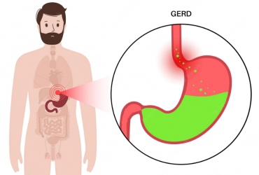 Comment savoir si le reflux gastrique est votre problème !