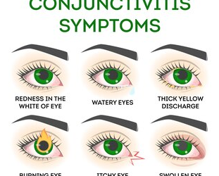 5 affections oculaires courantes de Problèmes de vision