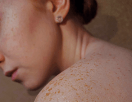 Le guide pratique des tissus conjonctifs, peau,cheveux,ongles 1 tissus conjonctifs