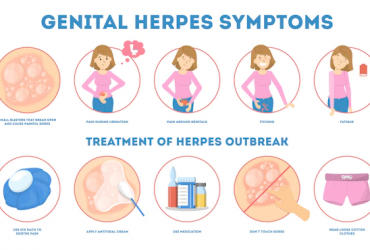 Vérifiez les symptômes de l’herpès !