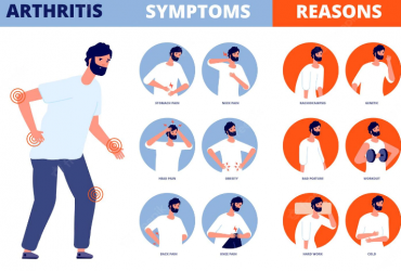 Comment arrêter l’arthrose – solutions et traitements.