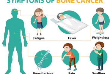 Comment vérifier les symptômes du cancer des os