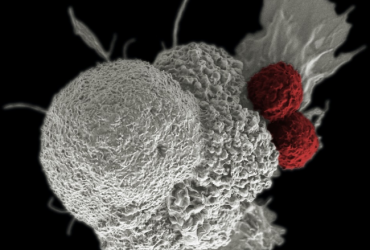 Comment vaincre le cancer avec l’immunothérapie
