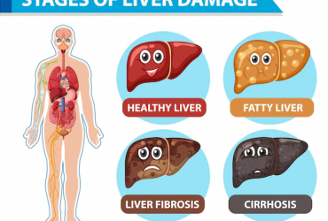 Comment traiter l’hémochromatose et préserver votre santé