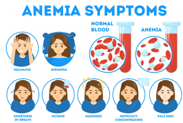Comment vérifier si vous avez des symptômes d’anémie ?
