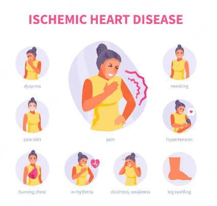 Comment rechercher les symptômes cardio-vasculaires ! 1 cardio vasculaires